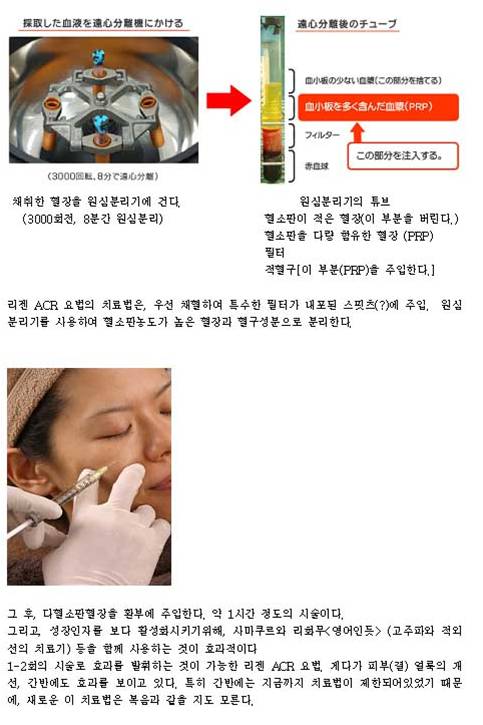 리젠 이미지