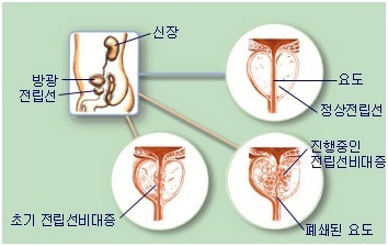 일중한의원 엠파스 공식블러그